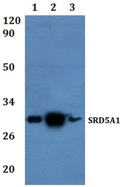 Invitrogen SRD5A1 Polyclonal Antibody 100 μL; Unconjugated:Antibodies,
