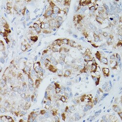 Invitrogen ALPL Polyclonal Antibody 100 &mu;L; Unconjugated:Antibodies,