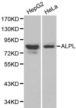 Invitrogen ALPL Polyclonal Antibody 100 &mu;L; Unconjugated:Antibodies,