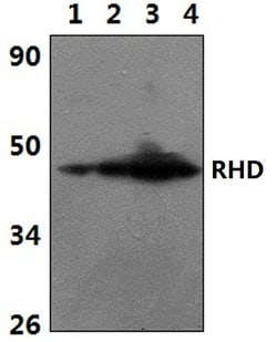 RHD Polyclonal Antibody:Antibodies, Polyclonal