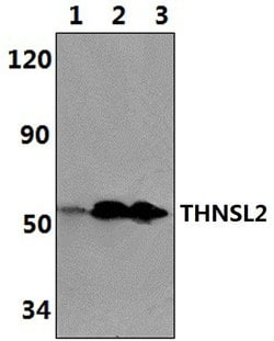 Invitrogen THNSL2 Polyclonal Antibody 100 &mu;L; Unconjugated:Antibodies,