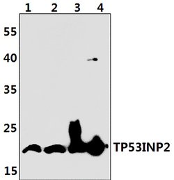 Invitrogen TP53INP2 Polyclonal Antibody 100 &mu;L; Unconjugated:Antibodies,