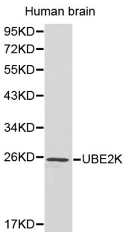 Invitrogen HIP2 Polyclonal Antibody 100 &mu;L; Unconjugated:Antibodies,