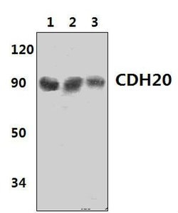 Invitrogen CDH20 Polyclonal Antibody 100 &mu;L; Unconjugated:Antibodies,