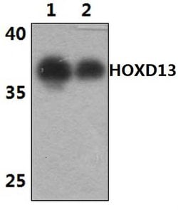 Invitrogen HOXD13 Polyclonal Antibody 100 &mu;L; Unconjugated:Antibodies,