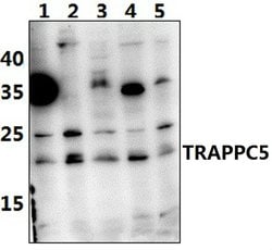 Invitrogen TRAPPC5 Polyclonal Antibody 100 &mu;L; Unconjugated:Antibodies,
