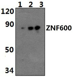 Invitrogen ZNF600 Polyclonal Antibody 100 &mu;L | Buy Online | Invitrogen&trade; | Fisher Scientific