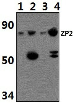 Invitrogen ZP2 Polyclonal Antibody 100 &mu;L; Unconjugated:Antibodies,
