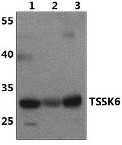 Invitrogen TSSK6 Polyclonal Antibody 100 &mu;L | Buy Online | Invitrogen&trade; | Fisher Scientific