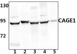 Invitrogen CAGE1 Polyclonal Antibody 100 &mu;L; Unconjugated:Antibodies,
