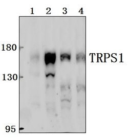 TRPS1 Polyclonal Antibody:Antibodies, Polyclonal