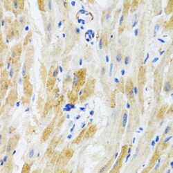 Invitrogen PHPT1 Polyclonal Antibody 100 &mu;L; Unconjugated:Antibodies,