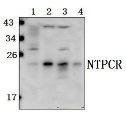 C1orf57 Polyclonal Antibody:Antibodies, Polyclonal