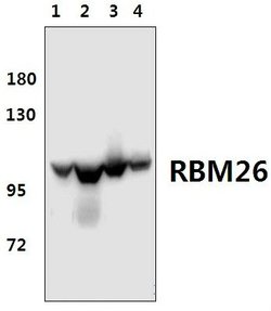 Invitrogen RBM26 Polyclonal Antibody 100 &mu;L; Unconjugated:Antibodies,