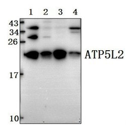 ATP5L2 Polyclonal Antibody:Antibodies, Polyclonal