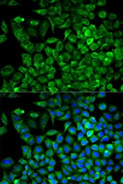 Invitrogen Aldolase A Polyclonal Antibody 100 &mu;L | Buy Online | Invitrogen&trade; | Fisher Scientific