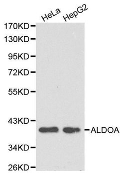 Invitrogen Aldolase A Polyclonal Antibody 100 &mu;L | Buy Online | Invitrogen&trade; | Fisher Scientific