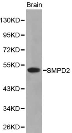 Invitrogen SMPD2 Polyclonal Antibody 100 &mu;L; Unconjugated:Antibodies,