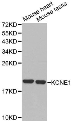 Invitrogen KCNE1 Polyclonal Antibody 100 &mu;L; Unconjugated:Antibodies,
