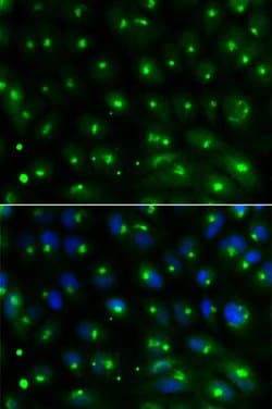 Invitrogen GGA2 Polyclonal Antibody 100 &mu;L; Unconjugated:Antibodies,