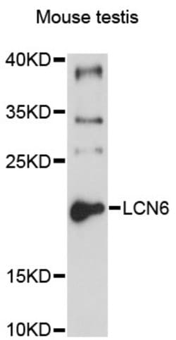Invitrogen LCN6 Polyclonal Antibody 100 &mu;L; Unconjugated:Antibodies,