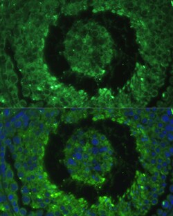 Invitrogen DEFB121 Polyclonal Antibody 100 &mu;L; Unconjugated:Antibodies,