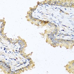 Invitrogen DEFB121 Polyclonal Antibody 100 &mu;L; Unconjugated:Antibodies,