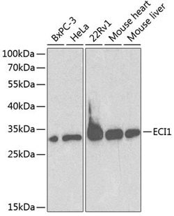 Invitrogen DCI Polyclonal Antibody 100 &mu;L | Buy Online | Invitrogen&trade; | Fisher Scientific