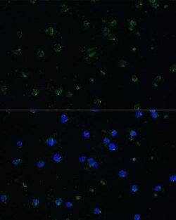 Invitrogen ARHGAP25 Polyclonal Antibody 100 &mu;L; Unconjugated:Antibodies,