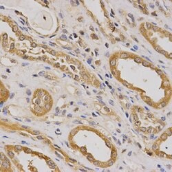 Invitrogen ARHGAP25 Polyclonal Antibody 100 &mu;L; Unconjugated:Antibodies,