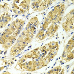 Invitrogen ARHGAP25 Polyclonal Antibody 100 &mu;L; Unconjugated:Antibodies,