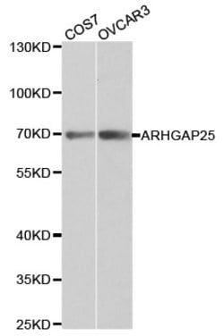 Invitrogen ARHGAP25 Polyclonal Antibody 100 &mu;L; Unconjugated:Antibodies,