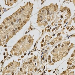 Invitrogen XRCC3 Polyclonal Antibody 100 &mu;L; Unconjugated:Antibodies,