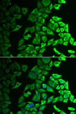 Invitrogen IL18BP Polyclonal Antibody 100 &mu;L; Unconjugated:Antibodies,