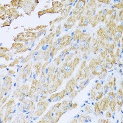 Invitrogen IL18BP Polyclonal Antibody 100 &mu;L; Unconjugated:Antibodies,