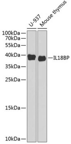 Invitrogen IL18BP Polyclonal Antibody 100 &mu;L; Unconjugated:Antibodies,