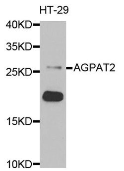 Invitrogen AGPAT2 Polyclonal Antibody 100 &mu;L; Unconjugated:Antibodies,