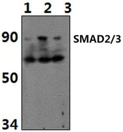 Acetyl-SMAD2/SMAD3 (Lys19) Polyclonal Antibody, Invitrogen 100 &mu;L; Unconjugated:Antibodies,