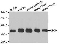 Invitrogen ATOH1 Polyclonal Antibody 100 &mu;L; Unconjugated:Antibodies,