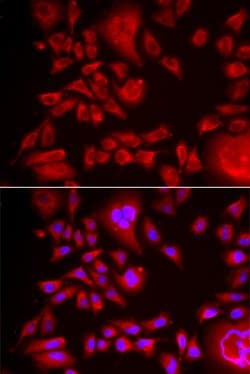 Invitrogen BLMH Polyclonal Antibody 100 &mu;L; Unconjugated:Antibodies,