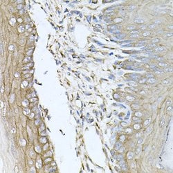 Invitrogen Calumenin Polyclonal Antibody 100 &mu;L; Unconjugated:Antibodies,