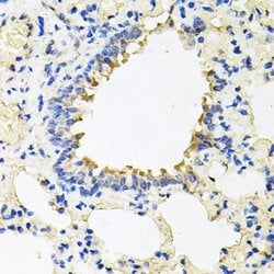 Invitrogen Calumenin Polyclonal Antibody 100 &mu;L; Unconjugated:Antibodies,
