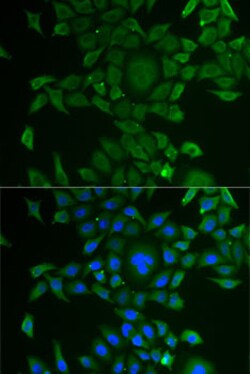 Invitrogen CCBL1 Polyclonal Antibody 100 &mu;L; Unconjugated:Antibodies,