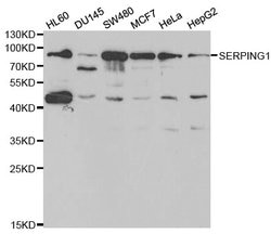 Invitrogen C1 inhibitor Polyclonal Antibody 100 &mu;L; Unconjugated:Antibodies,