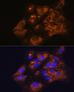 Invitrogen C1 inhibitor Polyclonal Antibody 100 &mu;L; Unconjugated:Antibodies,