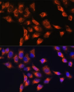 Invitrogen C1 inhibitor Polyclonal Antibody 100 &mu;L; Unconjugated:Antibodies,