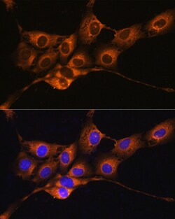 Invitrogen C1 inhibitor Polyclonal Antibody 100 &mu;L; Unconjugated:Antibodies,