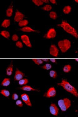 Invitrogen CBS Polyclonal Antibody 100 &mu;L; Unconjugated:Antibodies,