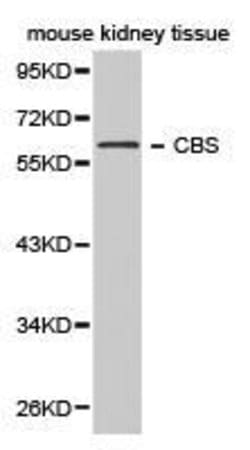 Invitrogen CBS Polyclonal Antibody 100 &mu;L; Unconjugated:Antibodies,