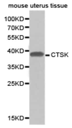 Invitrogen Cathepsin K Polyclonal Antibody 100 &mu;L; Unconjugated:Antibodies,